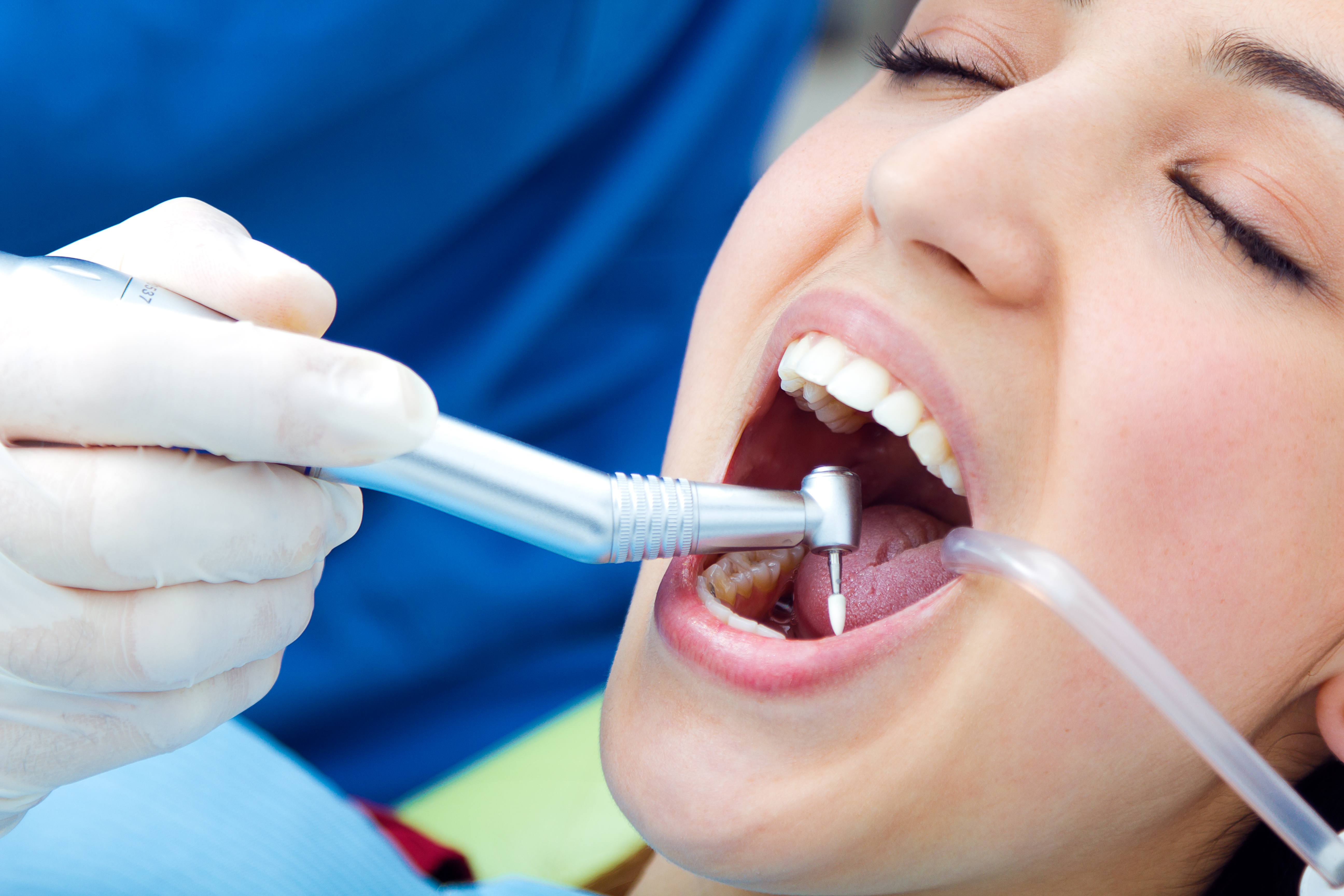 Teeth Cleaning Overview